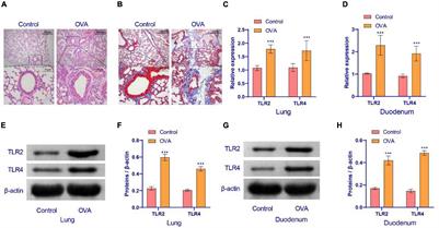Lactobacillus fermentum CECT5716 Alleviates the Inflammatory Response in Asthma by Regulating TLR2/TLR4 Expression